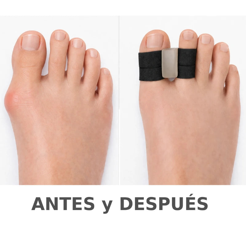Corrector Juanetes - Oferta hoy 1+1 gratis